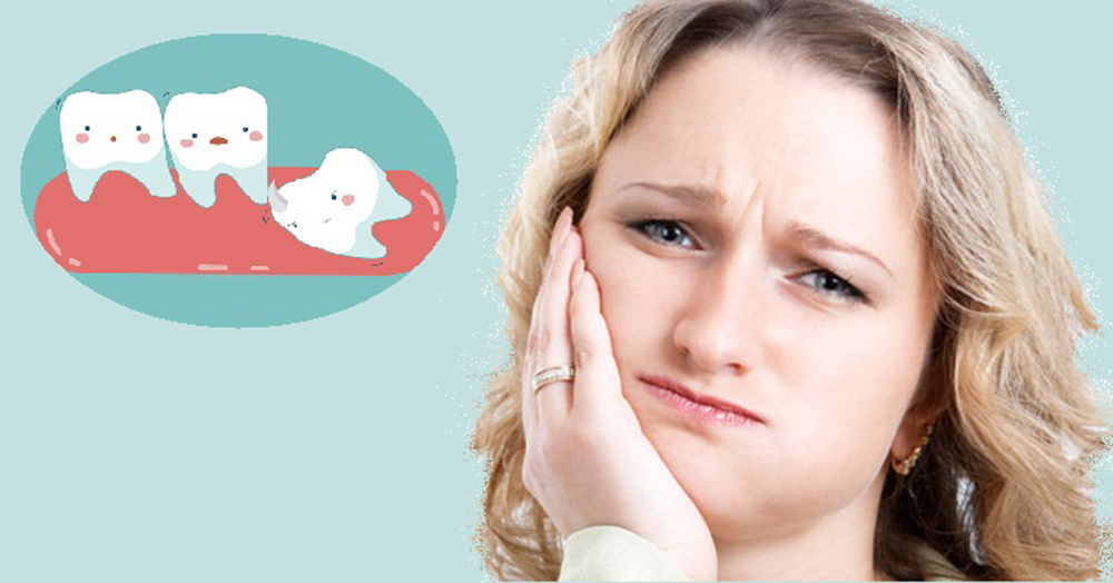 Biểu hiện của mọc răng khôn và sốt mọc răng khôn cần làm gì?